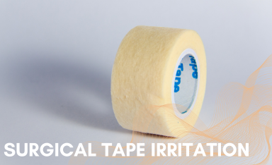You are currently viewing Understanding and Managing Skin Irritations from Surgical Tape: